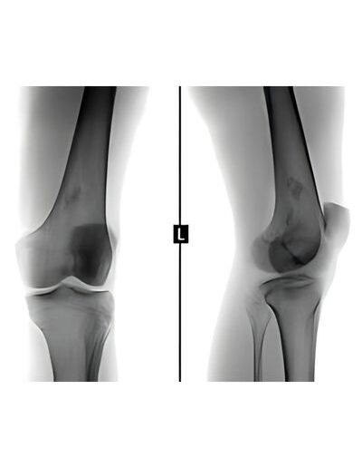 Bone_and_soft_tissue_tumors_21-400x516