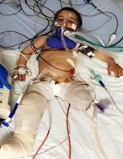 paediatric-trauma-service-gallery-3-400x516 (1)