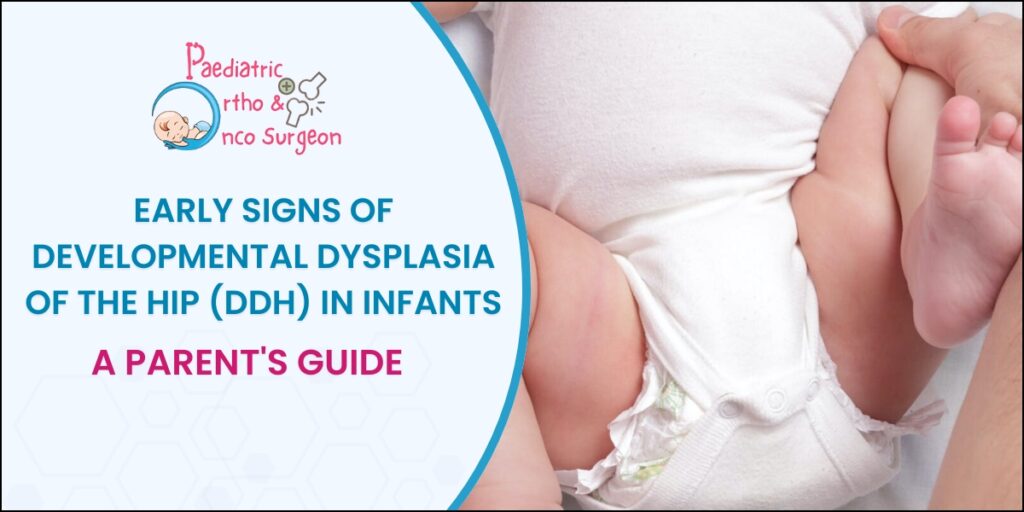Developmental Dysplasia of the Hip in Infants