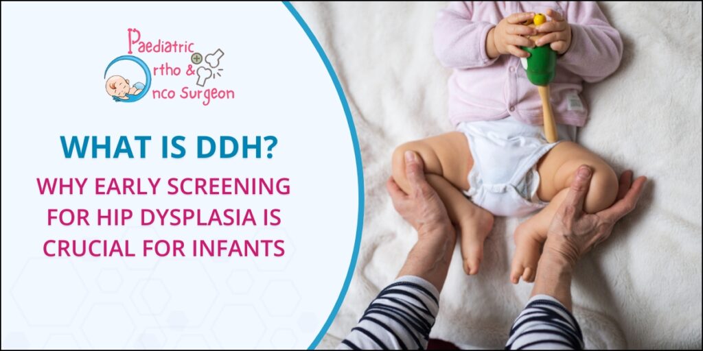 What is DDH in Infants