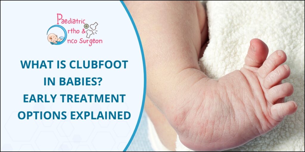 Clubfoot in kids