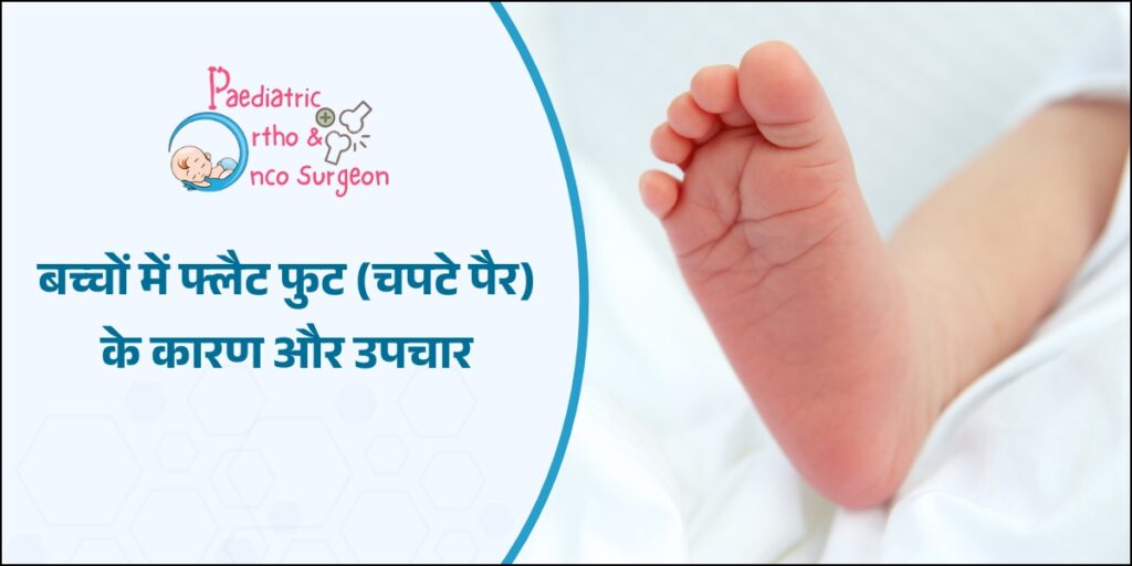 बच्चों में फ्लैट फुट के कारण और उपचार
